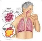 Quel terme désigne une accélération du rythme cardiaque ?