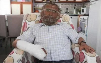 Voilà 4 heures que vous avez arrêté et les symptômes de sevrage sont cruels mais vous êtes prête à n'importe quoi, même à vous mettre une cage sur la tête ! Pour combien de jours en avez-vous de ce summum d'intensité de sevrage ?