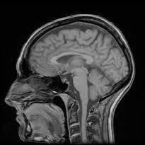 La matière grise compose ________ de ces hémisphères.