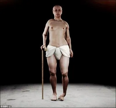 Quelle maladie a-t-il contractée pendant son adolescence ?