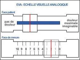 En médecine, l'échelle visuelle analogique permet d'évaluer facilement l'importance de divers symptômes. 
Lequel de ces symptômes ne peut être évalué par cette méthode ?