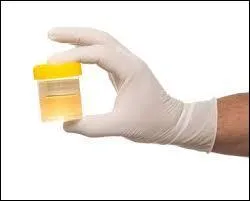 L'urine contient de nombreux composants. Il est normal d'y trouver du sodium.