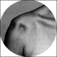 Une épaule, [ ... ].