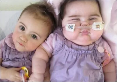 Une des deux pères réclame donc des tests de paternité vu cette différence. Mais qu'est-ce qui l'agaçait ?