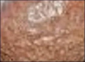 Quand le fruit le devient, comme la poire.