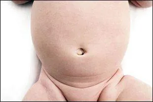 Quelles sont les principales zones du corps qui peuvent être touchées ?