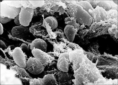 Le microorganisme responsable de la peste ne sera identifié qu'en 1894. Quel est son nom ?