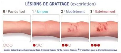 Quel est le risque des lésions de grattage ?