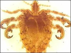 Cochez les parasitoses de cette liste.