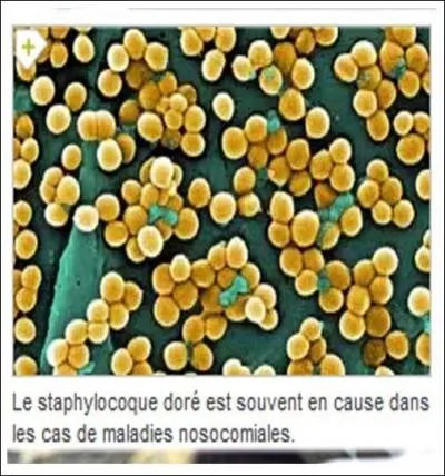 Cochez ici le (s) élément(s) responsable(s) de l'impétigo :