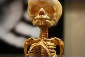 Combien un nourrisson humain possde-t-il d'os au total ?