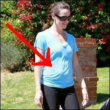 Cette ville porte le surnom d'une partie du corps humain. Comment s'appelle-t-elle ?