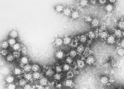 Quiz La poliomylite, vaccin obligatoire