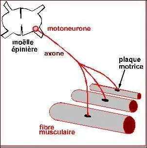 Qu'ont les personnes dont la poliomyélite a touché les moto-neurones ?