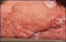 501 habitants, des Gersois, auront le plaisir de manger le veau rosé abattu à Auch mais élevé à Escornebuf - ça ne s'invente pas - et ayant obtenu le Veau d'or au concours de ------.