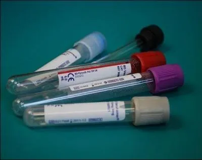 Pour quelle raison dose-t-on le taux de bilirubine dans le sang ?