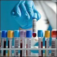 On recherche toujours la "créatinine " dans vos analyses de sang, car c'est un bon indicateur du fonctionnement du ... .