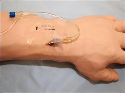 La question qui fait sourire. Complétez avec humour. " On lui a posé un ... dans la veine. "