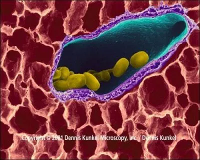 Quelle arme biologique est facile d'utilisation et tue environ 90% des sujets non traités ?