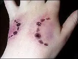 Quels sont les deux animaux de compagnie qui peuvent vous tuer ?