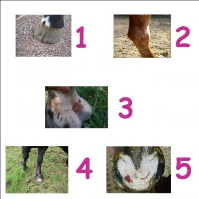 Les membres - Quels sont les noms des blessures : 5, 2, 4, 1, 3 ?