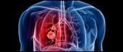 En prenant en compte les 2 poumons, de combien de lobes pulmonaires un être humain est-il doté ?