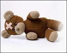 Si vous vous cassez l'ulna dans quelle partie du corps aurez-vous mal ?