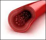 On ne dirait pas comme ça, mais un vaisseau sanguin, c'est un vrai mille-feuille composé de plusieurs couches.
Comment se nomme la couche en contact avec le sang ?