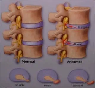 Laquelle de ces maladies est liée à ce quiz ?