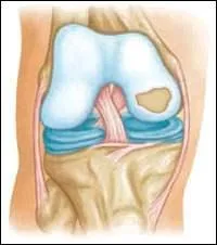 Qu'est-ce qui est en bleu ?