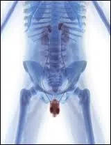 Il y un risque de stérilité pour un homme adulte qui attrape les oreillons.