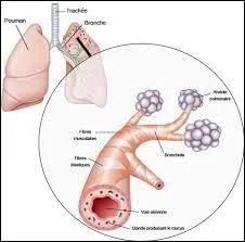 La bronchiolite est due à :