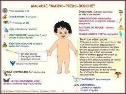 Le syndrome PMB est accompagné d'une très forte fièvre.