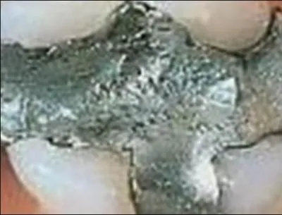 Qui est susceptible de vous faire ce genre d'amalgame ?