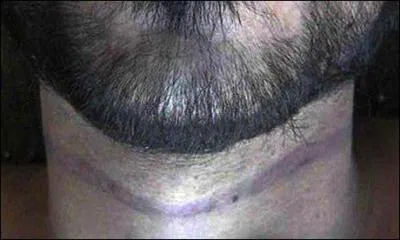 Qu'est-ce que 'l'homme pendu' ?