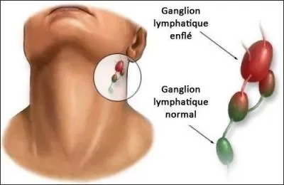 Combien avons-nous de ganglions lymphatiques dans le corps ?