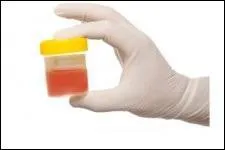 Que dé signe le terme médical "hématurie" ?