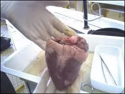 Les parties droites et gauches du cur communiquent-elles ?