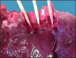 Quel organe sépare la ventricule de l'oreillette ?