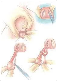 Comment empêcher la surpopulation de chats errants ?