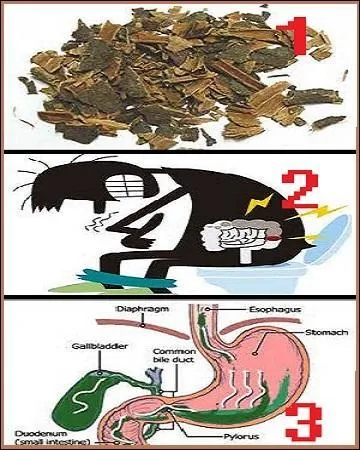 Que soigne la bourdaine (1) ?