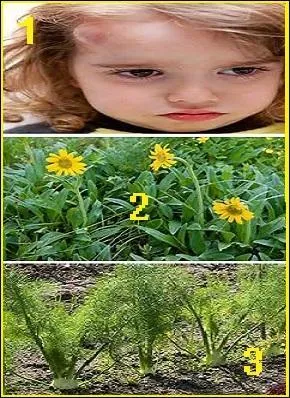 Quelle plante va soigner la petite fille (1) ?