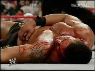 Lequel de ces catcheurs a stoppé sa carrière en s'étant tordu la jambe ?