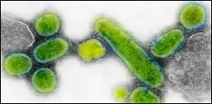 En 1917-1918, une pandémie frappe la France et tue 480 000 personnes. De quelle maladie s'agit-il ?