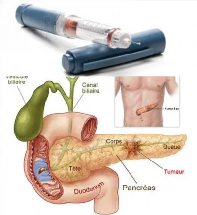 Dans le corps humain, il existe une glande qui sécrète une hormone permettant de garder notre taux de glycémie dans une plage acceptable.
Comment s'appelle cette glande et comment s'appelle cette hormone ?
