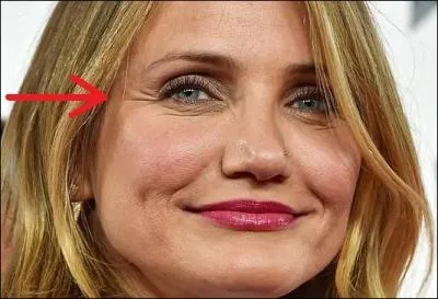 Il y aurait beaucoup à dire sur le visage de Cameron Diaz mais je vous demanderai simplement le nom des rides qu'elle a au coin de l'oeil ?