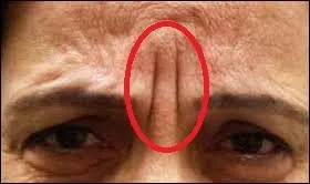 Connaissez-vous le nom de cette ride ?