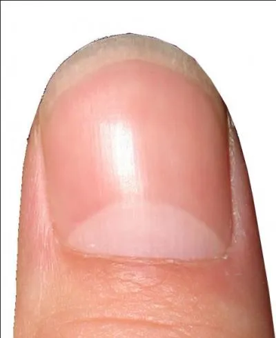 Comme tous les autres humains, vous avez bien &eacute;videmment regard&eacute; vos ongles et vous vous &ecirc;tes demand&eacute;s, quelle &eacute;tait cette tache blanche. Eh bien, comment se nomme-t-elle r&eacute;ellement ?