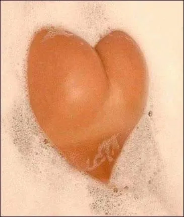 On m'a mis une ______ cardiaque.