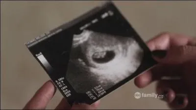 Comment aurait dû se nommer l'enfant de Ian et Melissa ?